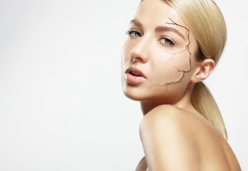 Cilt Çatlağı Neden Olur? Cilt Çatlağı Nasıl Geçer?